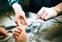 How to Choose the Right Surgeon for Duo Switch Surgery
