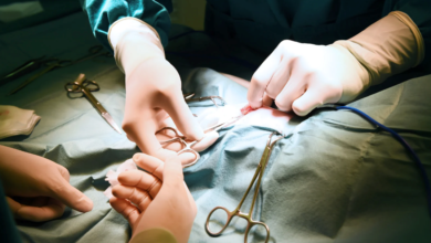 How to Choose the Right Surgeon for Duo Switch Surgery