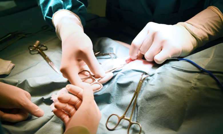 How to Choose the Right Surgeon for Duo Switch Surgery