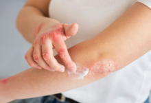 Understanding Early Signs Of Serious Skin Conditions