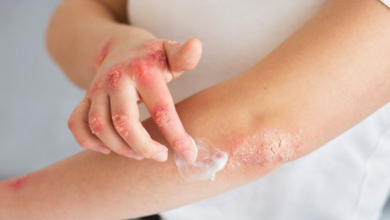 Understanding Early Signs Of Serious Skin Conditions