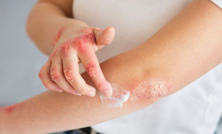 Understanding Early Signs Of Serious Skin Conditions