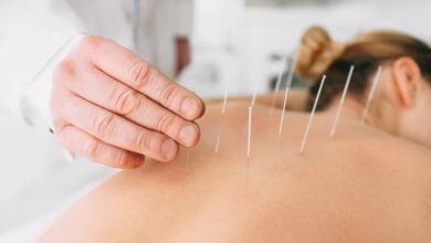 The Connection Between Acupuncture and Improved Sleep Quality
