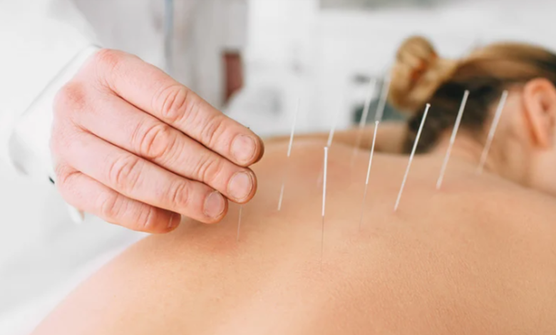The Connection Between Acupuncture and Improved Sleep Quality
