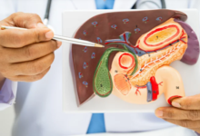 Understanding The Role Of Gallbladder Surgery In Relieving Pain
