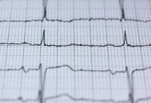 solar energy innovation ahead